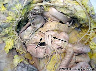 <p>what structure of the pancrease does the superior mesenteric artery pass through, as shown in the image?</p>