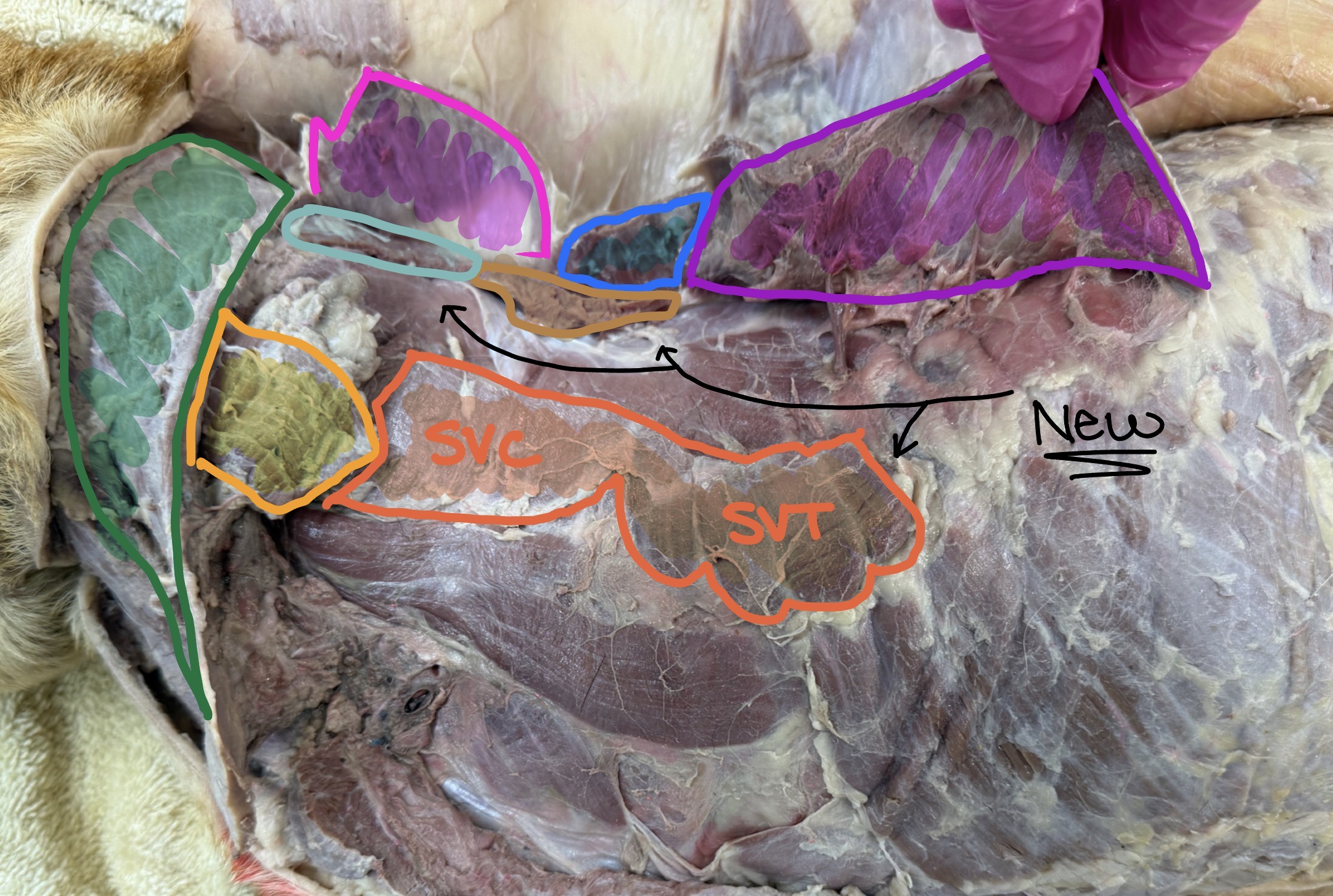 <p>What is the Dark Orange muscle?</p>