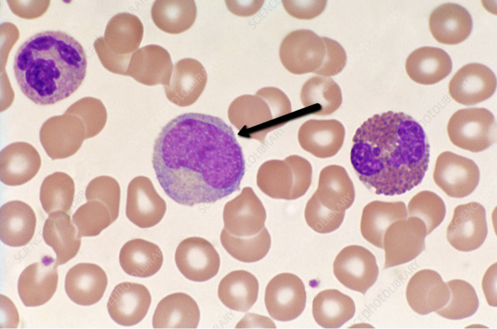 <p><strong>Identify the blood cell indicated by the pointer.</strong></p>