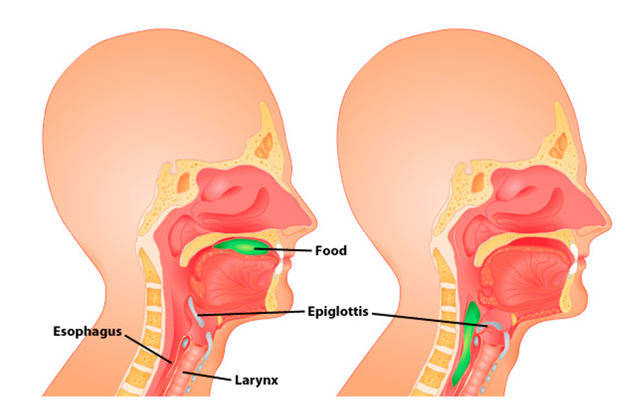 <ul><li><p>Surrounding muscles elevate the larynx</p></li><li><p>The glottis is closed by the epiglottis</p><ul><li><p>Prevents food and liquids from entering the larynx </p></li></ul></li></ul><p></p>