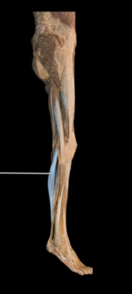 <p>What muscle is this?</p>