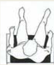 <p>Transverse plane pelvic rotation</p>