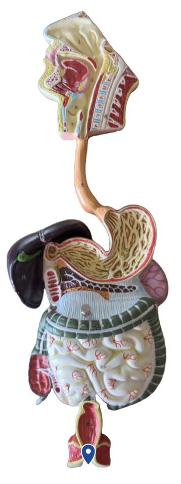 <p>Name this opening.</p>