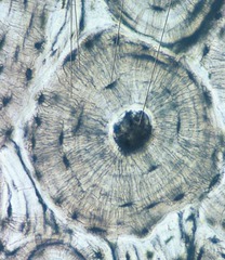 <p>tree trunk</p>