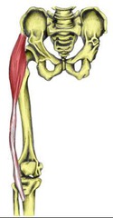 <p>outer lip of iliac crest</p>