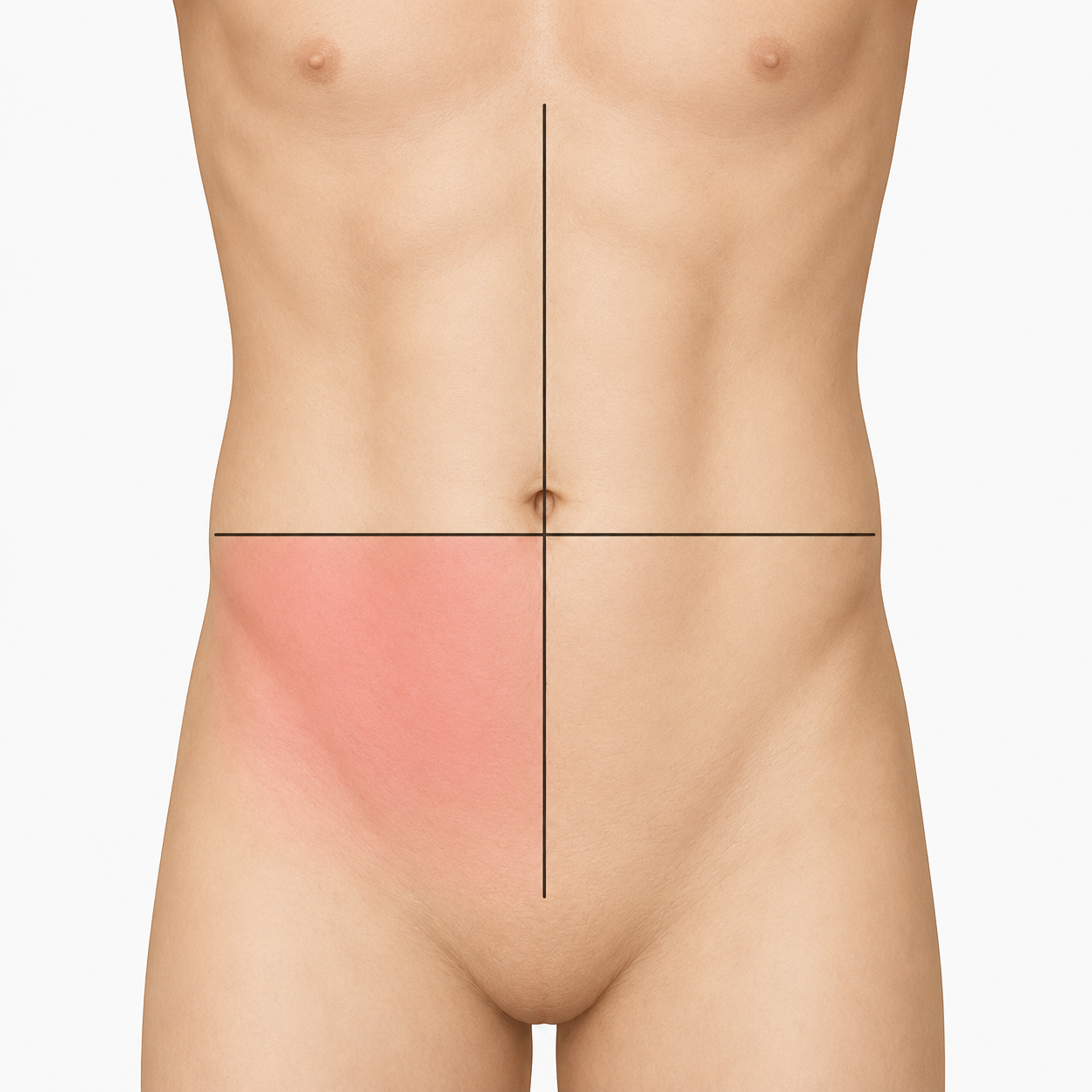 <p>Which abdominal quadrant is highlighted?</p>