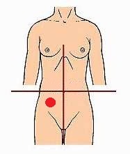 <p>identify the region of the abdomen:</p>