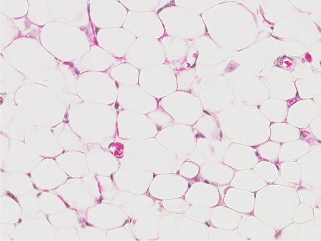 <p><span style="font-family: "Calibri Light";">Which type of CT is this?</span></p>