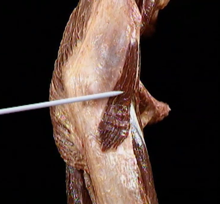 <p>Diep, lateraal aanzicht</p>