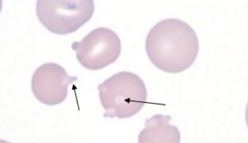 term image
