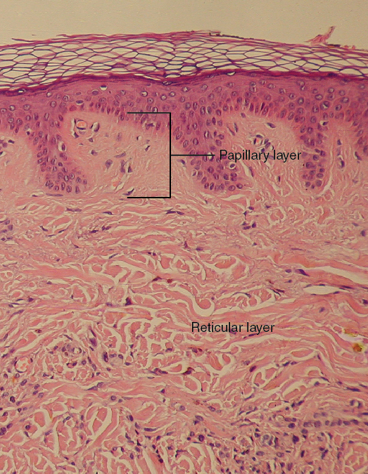 <p>Located between epidermis and subcutaneous layer; anchors epidermal accessory structures</p>