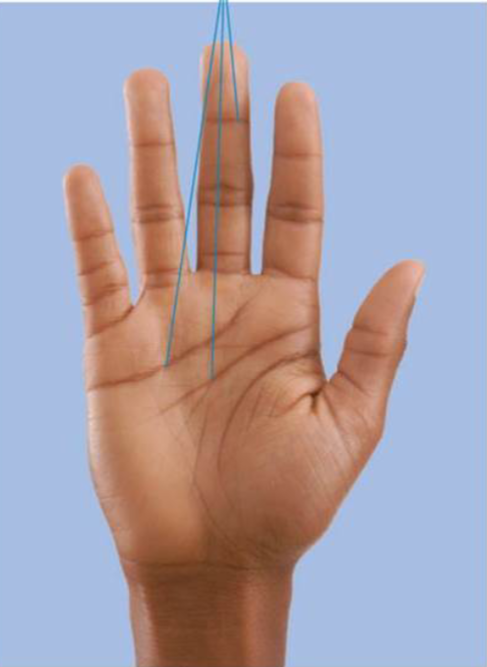 <p>Flexure lines </p>