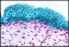 <p>Bladder, ureters (stretchable).</p>
