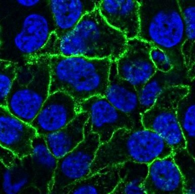 <p>cell nucleus (nuclear location) (DNA stain not primary antibody cell marker) </p>