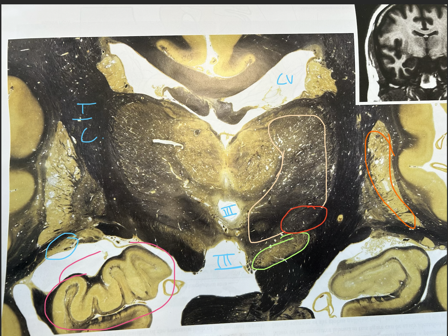 <p>whats in light blue</p>