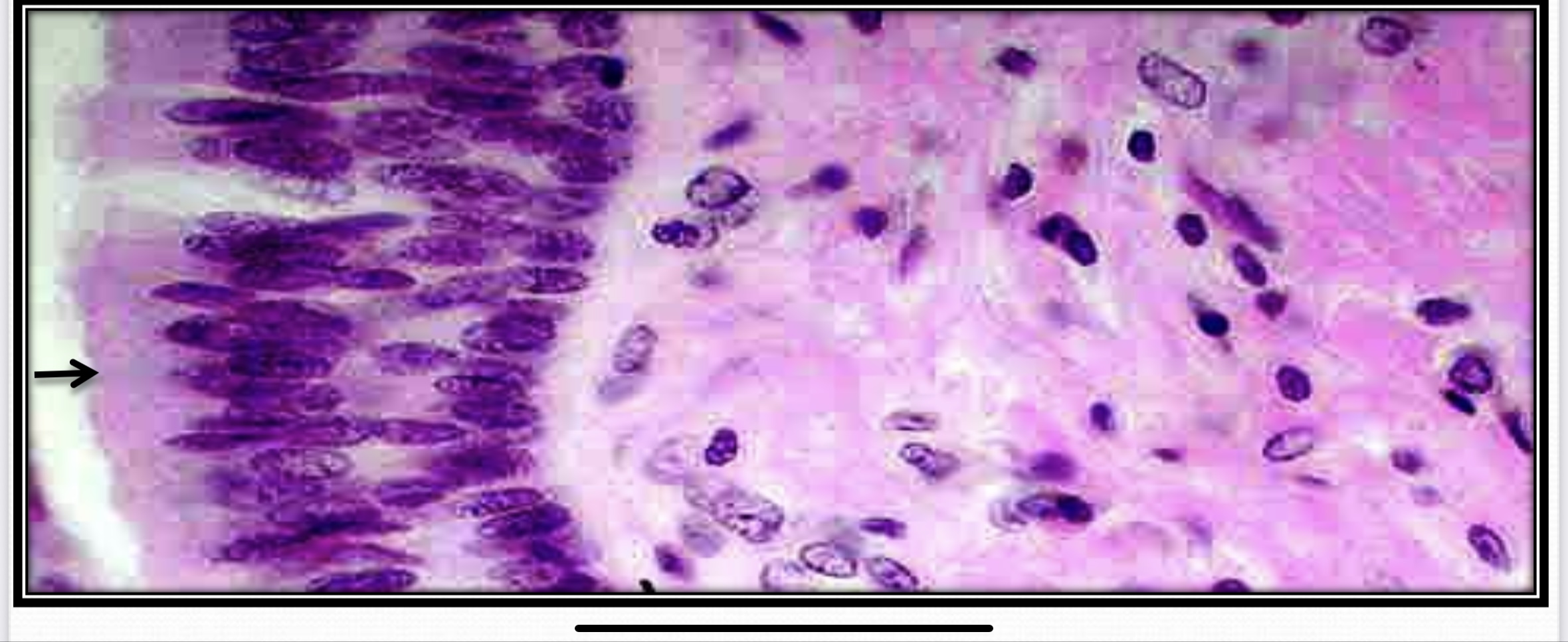 <p>Transitional Epithelium (Urothelium)</p>