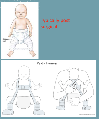 <p>spica cast; pavlik harness</p>
