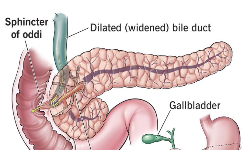 <p><span>muscular valve surrounding the exit of the bile and pancreatic ducts into the small intestine, controlling digestive fluid flow</span></p>