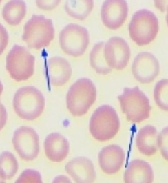 <p>what is it (Staining Blood Smears)</p>