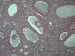<p>Identify the organ from which this tissue is located.</p>