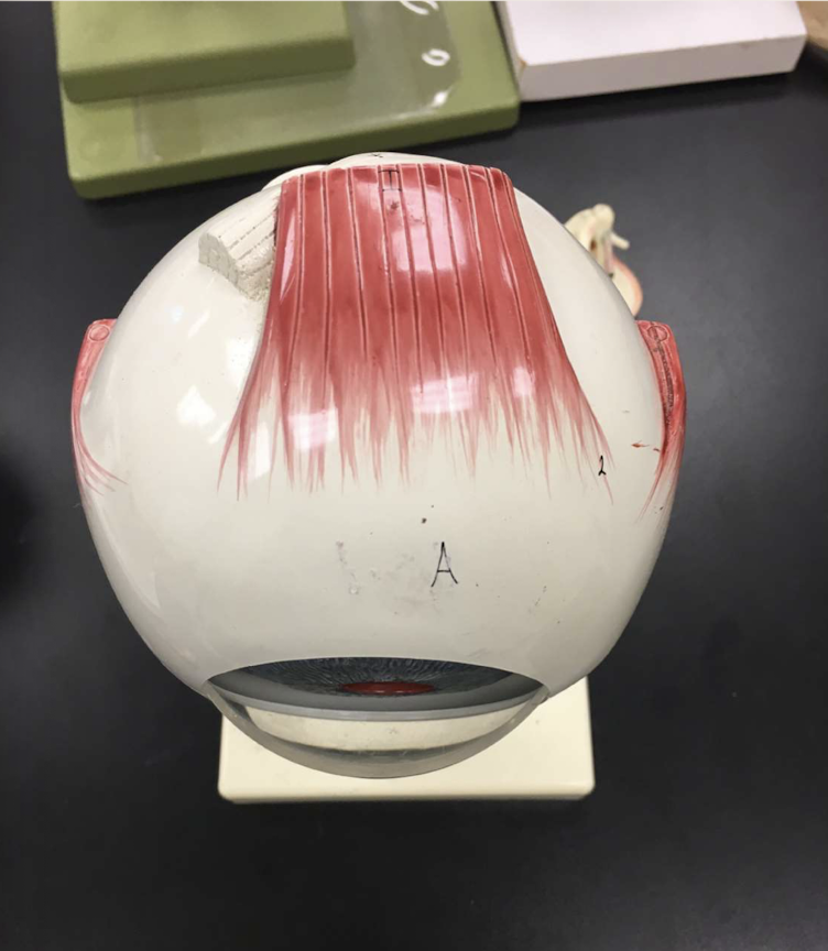 <p>What side of the eye is this?</p>