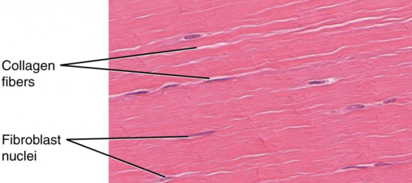 <p>Dense regular CT</p>