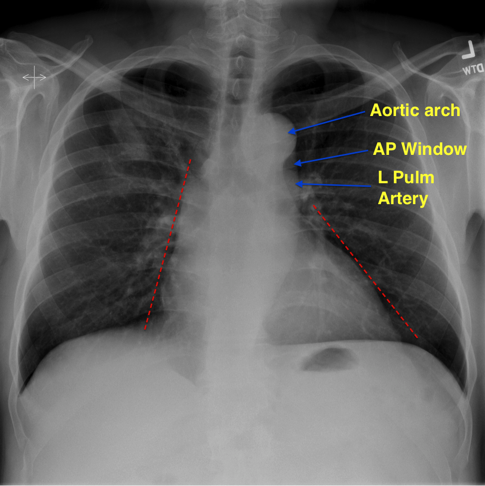 <p>located on the left side </p>