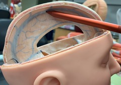 <p>A venous sinus located in the midline at the superior margin in the falx cerebri, between the two cerebral hemispheres.</p>