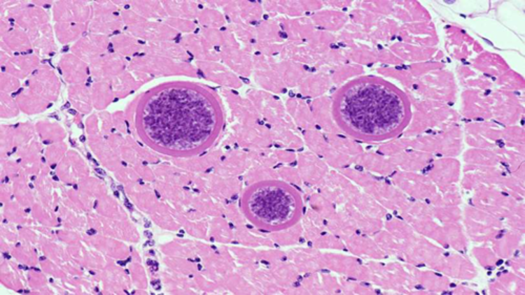 <p><span>Muscle Biopsy</span></p>