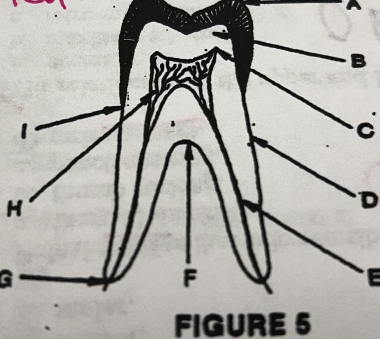 <p>In figure 5, the pulp horn is identified by letter</p>