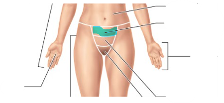 <p>area overlying the pelvis anteriorly</p>