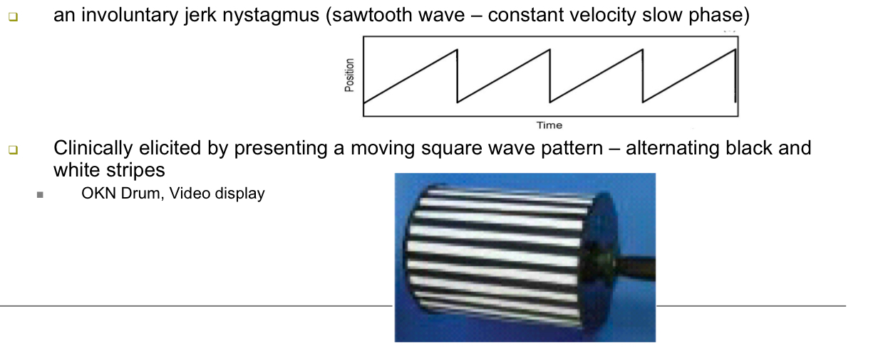 <p>Sawtooth wave with a constant-velocity slow phase — because the driving stimulus (stripes) moves at constant velocity</p>