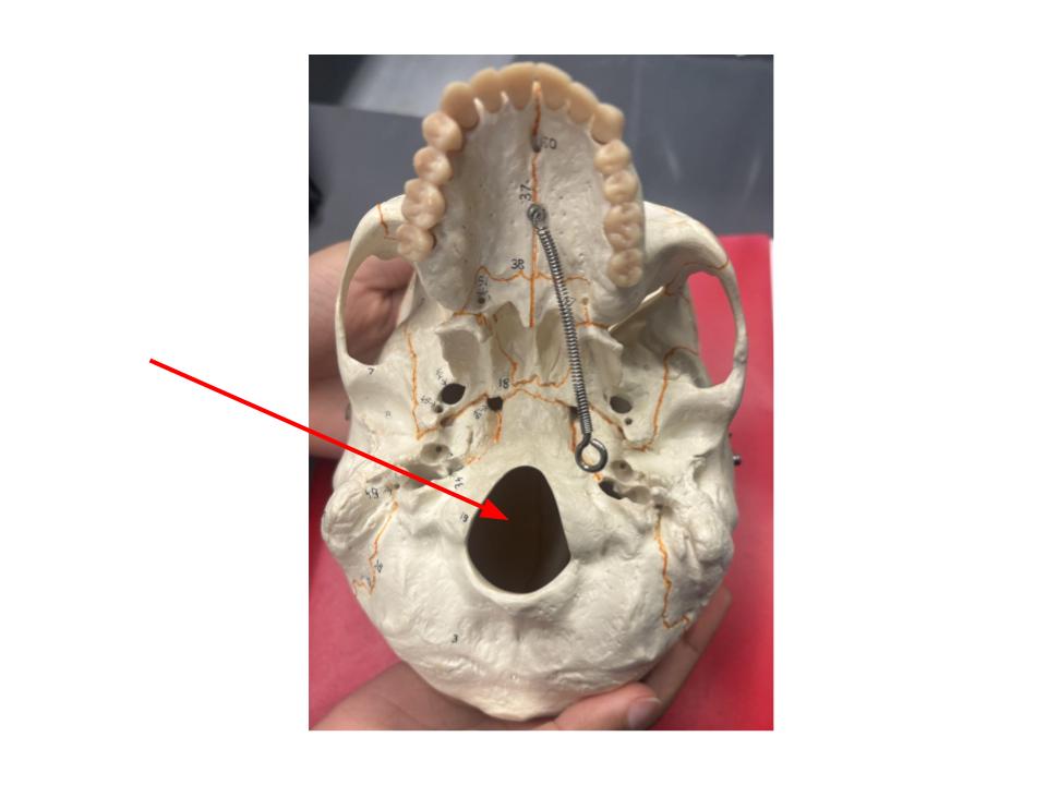<p>opening that joins spinal cord to brain</p>