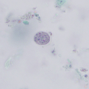 <p>6-12 um</p>