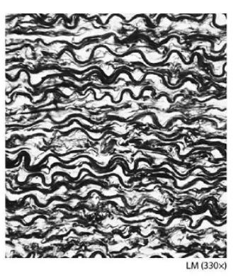 <p>what fibers are common in this tissue</p>