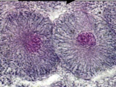 <p>What phase is this cell(s) in?</p>