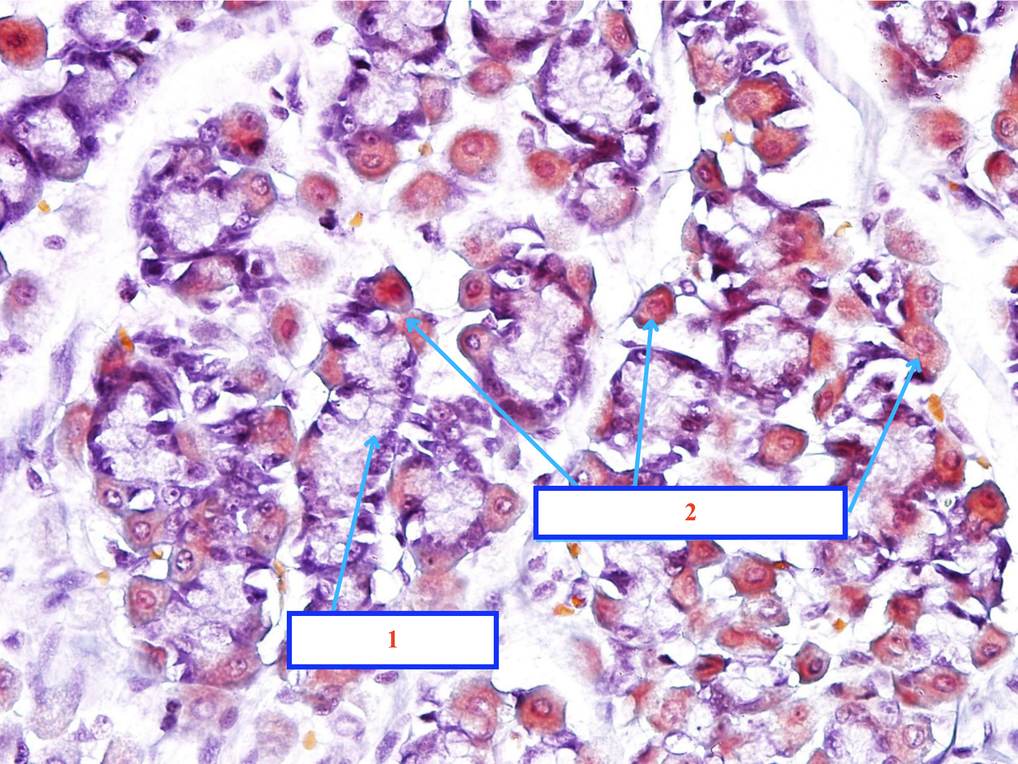 <p>Tế bào gì ?</p>