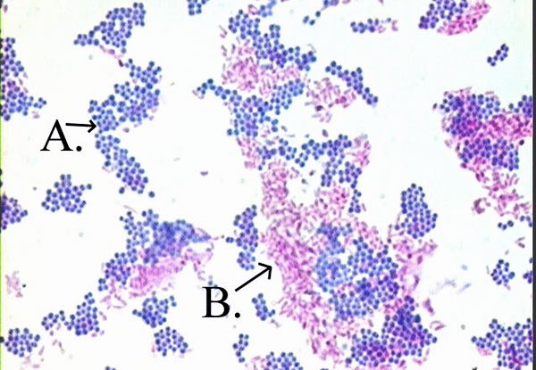 <p>What type of staining is shown in the image? </p>
