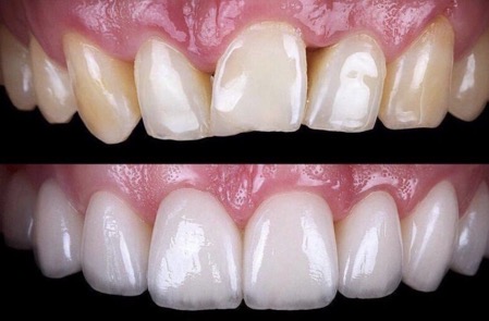 <p>What dental specialty is being displayed here?</p>