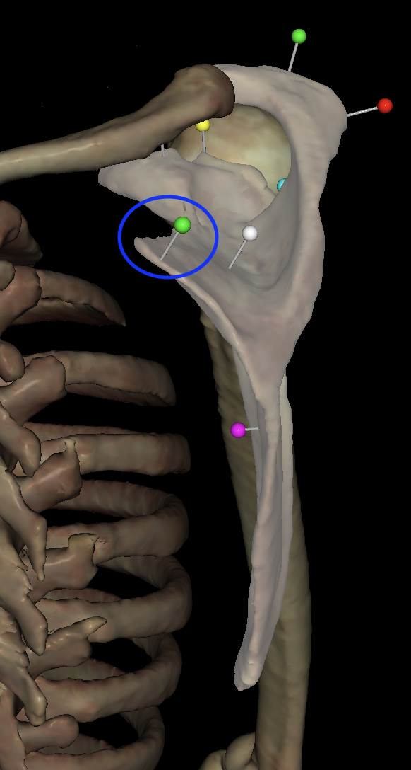 <p>What is the <mark data-color="#ccfbc7" style="background-color: rgb(204, 251, 199); color: inherit;">green</mark> tag on the<strong> right </strong>scapula?</p>