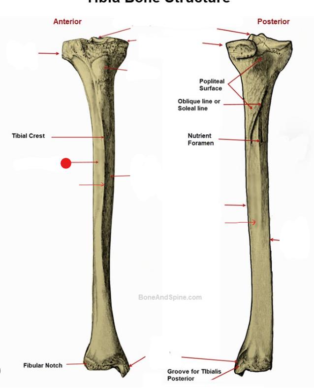 <p>Identify the structure pinned</p>