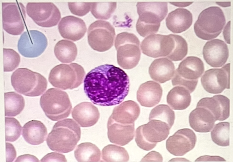 <p>identify the highlighted cell type at the pointer (Give complete answer - NO abbreviations)</p>