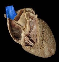 <p>identify the structure</p>