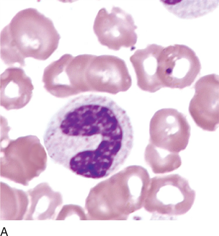 <p>what is a banded neutrophil?</p>