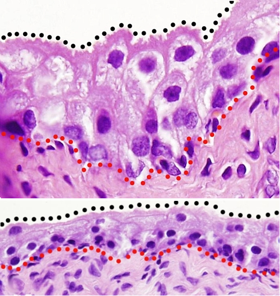 <p>urinary bladder</p>