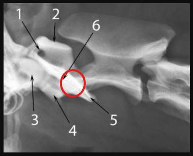 <p>Odontoid peg </p>