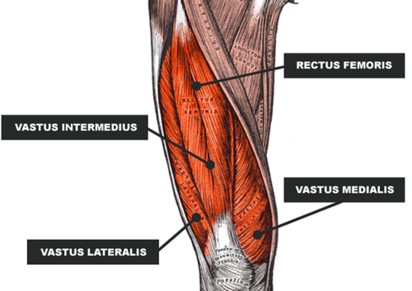<p>Quadriceps femoris group: rectus femoris, vastus intermedius, and vastus lateralis</p>