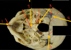 <p>What is labeled 2 on the developing skull?</p>
