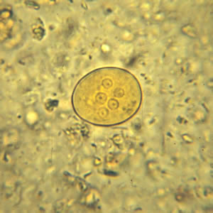 <p>10-35 um</p>