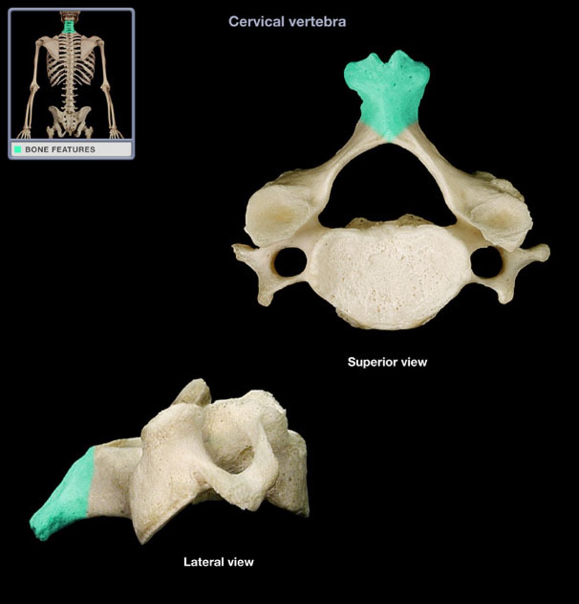 <p>(name of the vertebra part)</p>